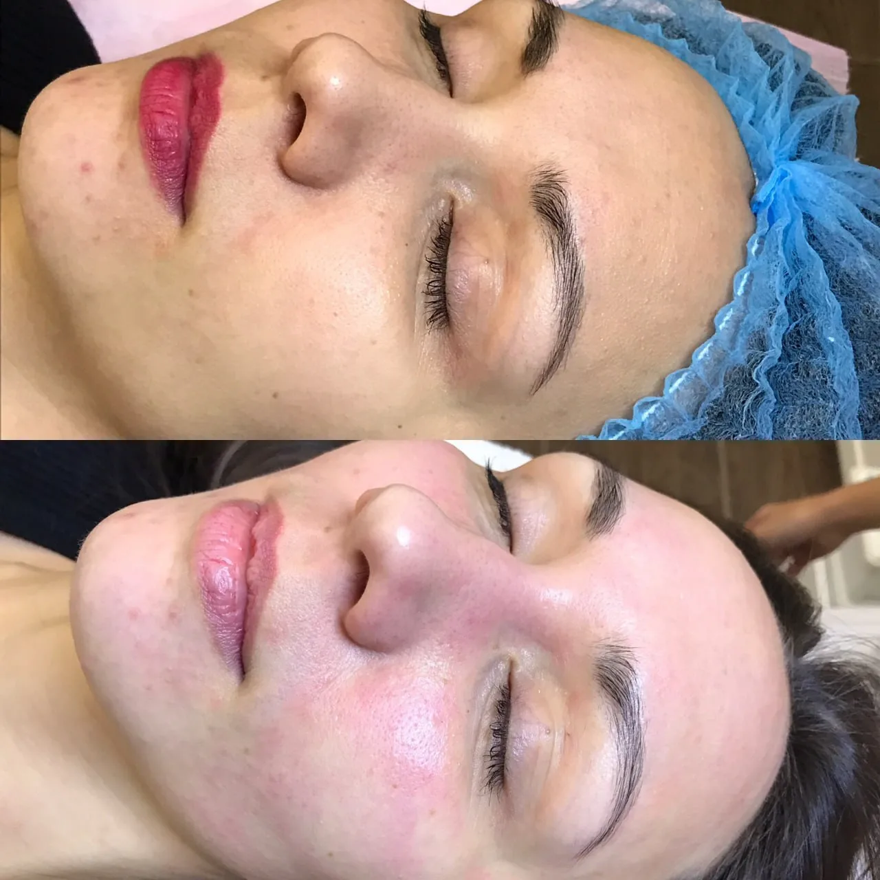 Facial cleanse before and after