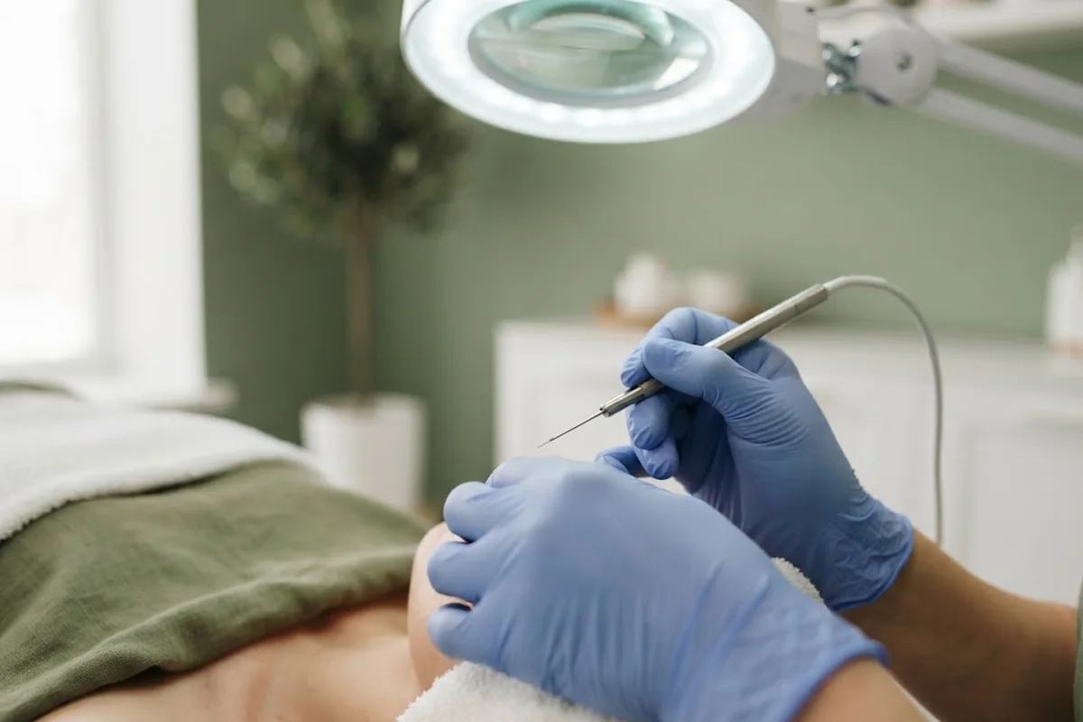 Gloved hands holding a fine electrolysis probe under a magnifying lamp in an Irvine CA studio